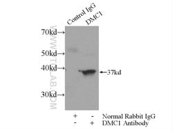 DMC1 Rabbit anti-Human, Mouse, Rat, Polyclonal, Proteintech 150 &mu;L;