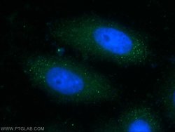 LSS Rabbit anti-Human, Mouse, Rat, Polyclonal, Proteintech:Antibodies:Primary