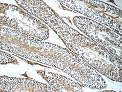 LSS Rabbit anti-Human, Mouse, Rat, Polyclonal, Proteintech:Antibodies:Primary