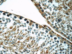 LSS Rabbit anti-Human, Mouse, Rat, Polyclonal, Proteintech:Antibodies:Primary