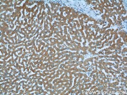 LSS Rabbit anti-Human, Mouse, Rat, Polyclonal, Proteintech:Antibodies:Primary
