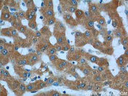 LSS Rabbit anti-Human, Mouse, Rat, Polyclonal, Proteintech:Antibodies:Primary