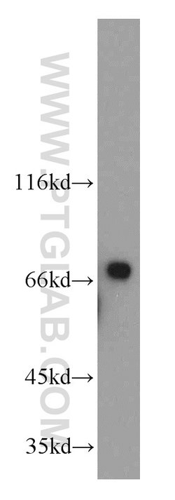 LSS Rabbit anti-Human, Mouse, Rat, Polyclonal, Proteintech:Antibodies:Primary