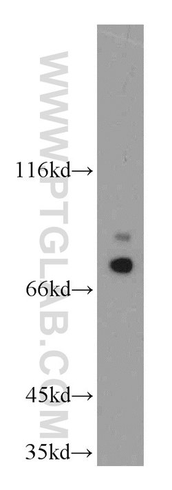 LSS Rabbit anti-Human, Mouse, Rat, Polyclonal, Proteintech:Antibodies:Primary