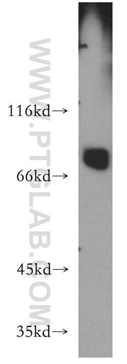 LSS Rabbit anti-Human, Mouse, Rat, Polyclonal, Proteintech:Antibodies:Primary