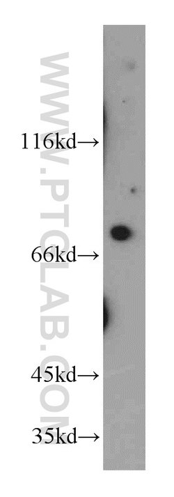 LSS Rabbit anti-Human, Mouse, Rat, Polyclonal, Proteintech:Antibodies:Primary