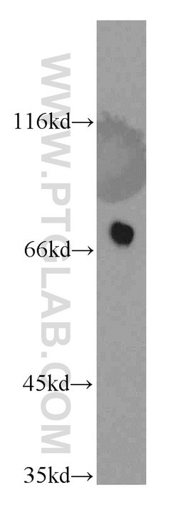LSS Rabbit anti-Human, Mouse, Rat, Polyclonal, Proteintech:Antibodies:Primary
