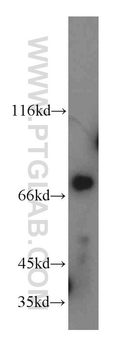 LSS Rabbit anti-Human, Mouse, Rat, Polyclonal, Proteintech:Antibodies:Primary