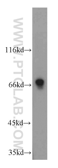 LSS Rabbit anti-Human, Mouse, Rat, Polyclonal, Proteintech:Antibodies:Primary