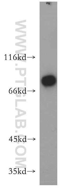 LSS Rabbit anti-Human, Mouse, Rat, Polyclonal, Proteintech:Antibodies:Primary