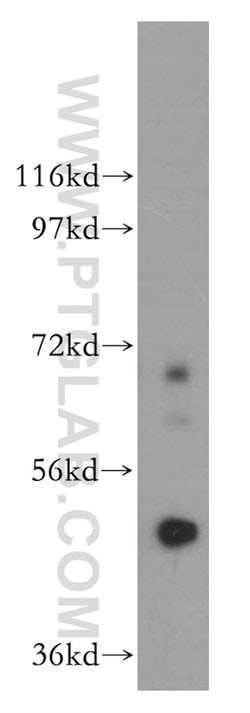 Carboxypeptidase A5 Rabbit anti-Human, Mouse, Rat, Polyclonal, Proteintech:Antibodies:Primary