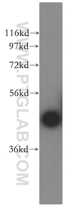 CA14 Rabbit anti-Human, Mouse, Rat, Polyclonal, Proteintech 150 &mu;L;