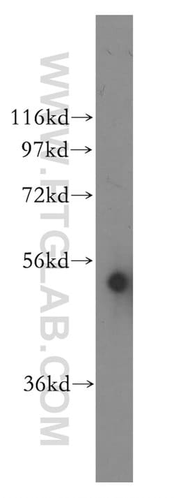 CYP3A5 Rabbit anti-Human, Polyclonal, Proteintech:Antibodies:Primary Antibodies