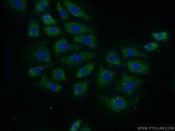 MTG1 Rabbit anti-Human, Mouse, Rat, Polyclonal, Proteintech 150 μL;