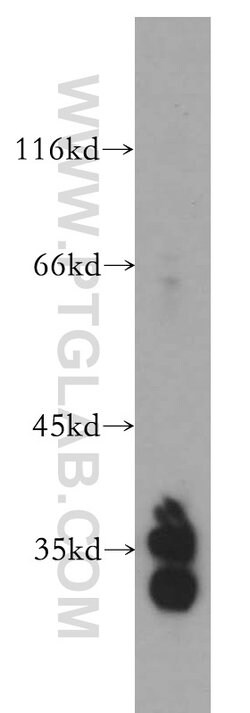 MTG1 Rabbit anti-Human, Mouse, Rat, Polyclonal, Proteintech 150 μL;