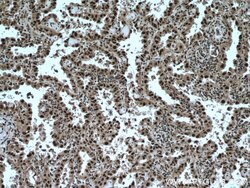 TRIM22 Rabbit anti-Human, Mouse, Polyclonal, Proteintech:Antibodies:Primary