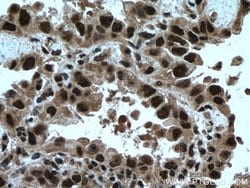 TRIM22 Rabbit anti-Human, Mouse, Polyclonal, Proteintech:Antibodies:Primary