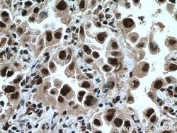 TRIM22 Rabbit anti-Human, Mouse, Polyclonal, Proteintech:Antibodies:Primary