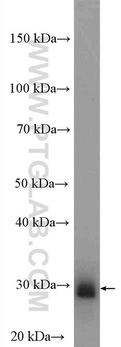 KCNIP4 Rabbit anti-Human, Mouse, Rat, Polyclonal, Proteintech:Antibodies:Primary