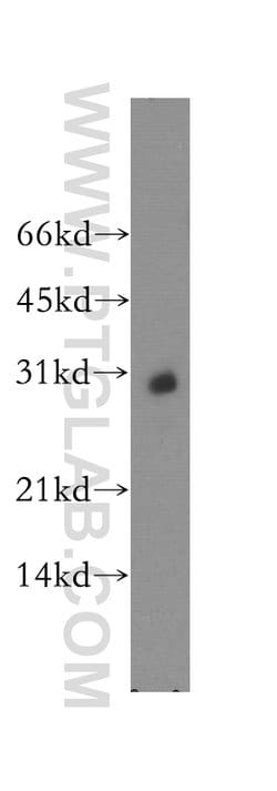 KCNIP4 Rabbit anti-Human, Mouse, Rat, Polyclonal, Proteintech:Antibodies:Primary