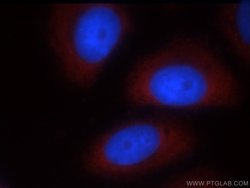 FMRP Rabbit anti-Human, Mouse, Rat, Polyclonal, Proteintech:Antibodies:Primary