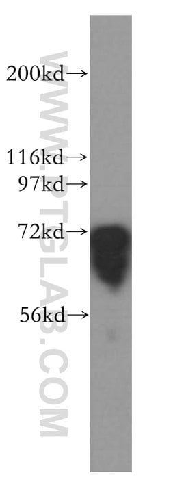 FMRP Rabbit anti-Human, Mouse, Rat, Polyclonal, Proteintech:Antibodies:Primary