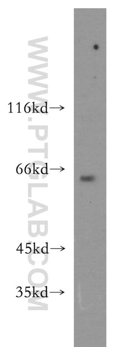 CDC2L6 Rabbit anti-Human, Mouse, Rat, Polyclonal, Proteintech