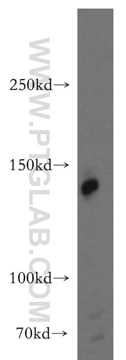 AMBRA1 Rabbit anti-Human, Mouse, Rat, Polyclonal, Proteintech 150 &mu;L;