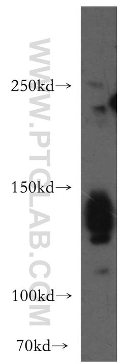 AMBRA1 Rabbit anti-Human, Mouse, Rat, Polyclonal, Proteintech 150 &mu;L;