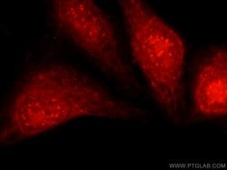 PFKFB3 Rabbit anti-Human, Mouse, Rat, Polyclonal, Proteintech:Antibodies:Primary
