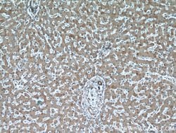 PFKFB3 Rabbit anti-Human, Mouse, Rat, Polyclonal, Proteintech:Antibodies:Primary