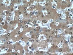 PFKFB3 Rabbit anti-Human, Mouse, Rat, Polyclonal, Proteintech:Antibodies:Primary
