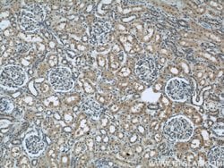 PFKFB3 Rabbit anti-Human, Mouse, Rat, Polyclonal, Proteintech:Antibodies:Primary