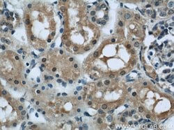 PFKFB3 Rabbit anti-Human, Mouse, Rat, Polyclonal, Proteintech:Antibodies:Primary