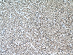 PFKFB3 Rabbit anti-Human, Mouse, Rat, Polyclonal, Proteintech:Antibodies:Primary