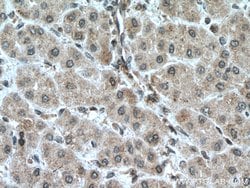PFKFB3 Rabbit anti-Human, Mouse, Rat, Polyclonal, Proteintech:Antibodies:Primary