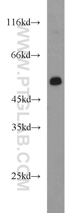 PFKFB3 Rabbit anti-Human, Mouse, Rat, Polyclonal, Proteintech:Antibodies:Primary