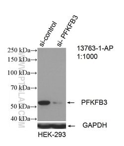 PFKFB3 Rabbit anti-Human, Mouse, Rat, Polyclonal, Proteintech:Antibodies:Primary