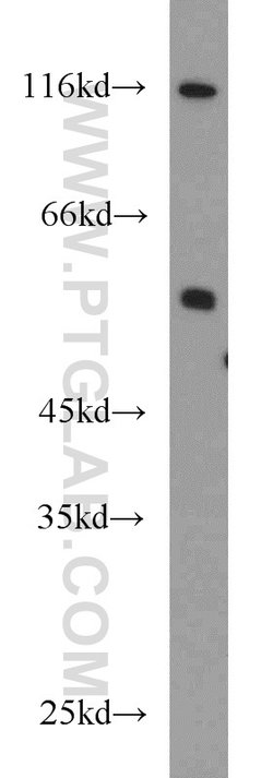 PFKFB3 Rabbit anti-Human, Mouse, Rat, Polyclonal, Proteintech:Antibodies:Primary
