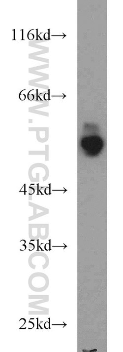 PFKFB3 Rabbit anti-Human, Mouse, Rat, Polyclonal, Proteintech:Antibodies:Primary
