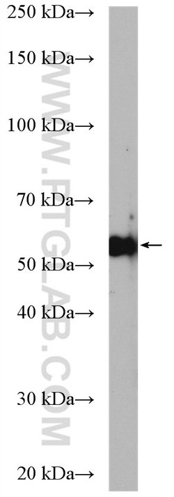PFKFB3 Rabbit anti-Human, Mouse, Rat, Polyclonal, Proteintech:Antibodies:Primary