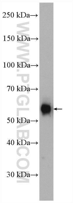 PFKFB3 Rabbit anti-Human, Mouse, Rat, Polyclonal, Proteintech:Antibodies:Primary