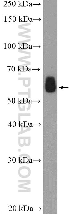 PFKFB3 Rabbit anti-Human, Mouse, Rat, Polyclonal, Proteintech:Antibodies:Primary