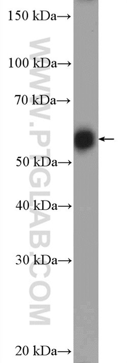 PFKFB3 Rabbit anti-Human, Mouse, Rat, Polyclonal, Proteintech:Antibodies:Primary