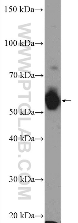 PFKFB3 Rabbit anti-Human, Mouse, Rat, Polyclonal, Proteintech:Antibodies:Primary