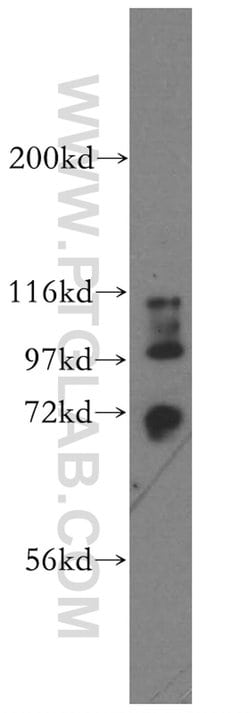 STXBP3 Rabbit anti-Human, Mouse, Rat, Polyclonal, Proteintech:Antibodies:Primary