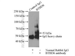 BTBD6 Rabbit anti-Human, Mouse, Rat, Polyclonal, Proteintech 150 &mu;L;