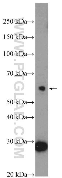 BTBD6 Rabbit anti-Human, Mouse, Rat, Polyclonal, Proteintech 150 &mu;L;