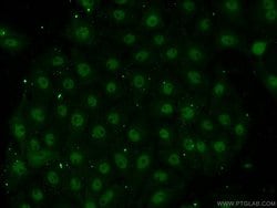 EAF1 Rabbit anti-Human, Mouse, Rat, Polyclonal, Proteintech 150 &mu;L;