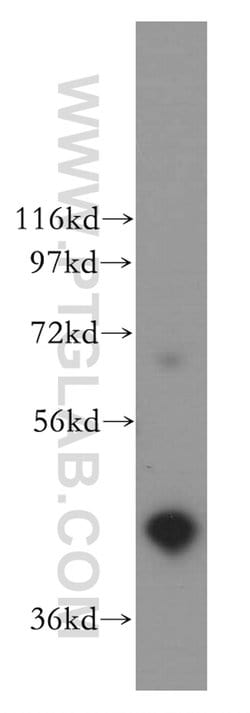 EAF1 Rabbit anti-Human, Mouse, Rat, Polyclonal, Proteintech 150 &mu;L;
